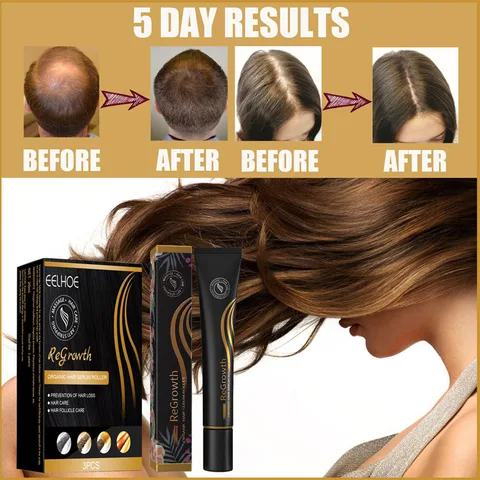 Hair Growth Serum Hair loss Regrow Fast Hair Growth