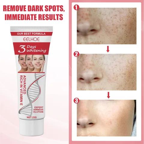 Whitening Face Cream Deep Moisturizer Remove Dark Spots